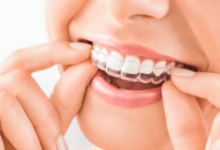 How Advanced Orthodontic Techniques Improve Long Term Dental Health