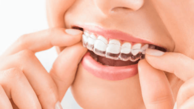 How Advanced Orthodontic Techniques Improve Long Term Dental Health