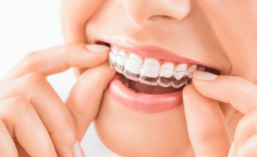 How Advanced Orthodontic Techniques Improve Long Term Dental Health
